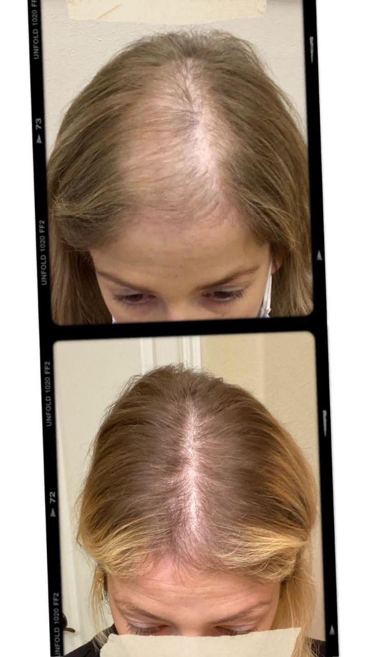 Ergebnis