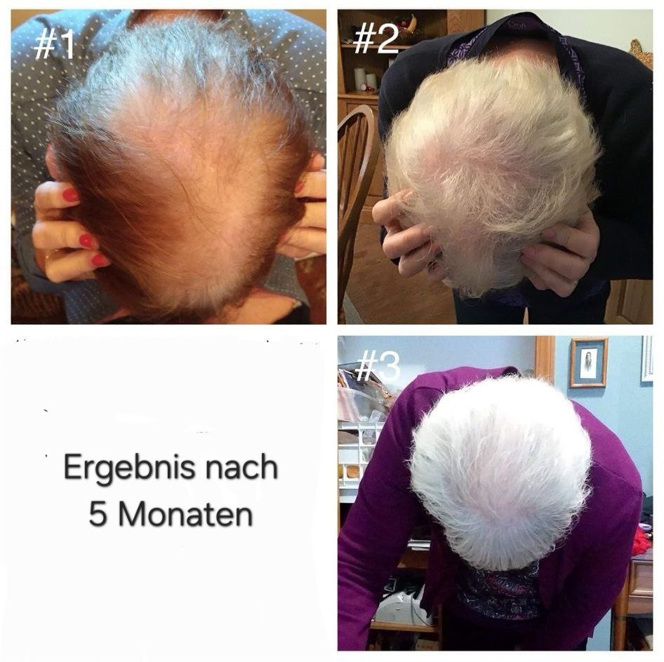Ergebnis
