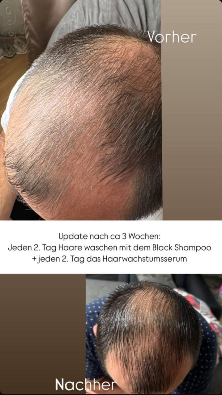 Ergebnis