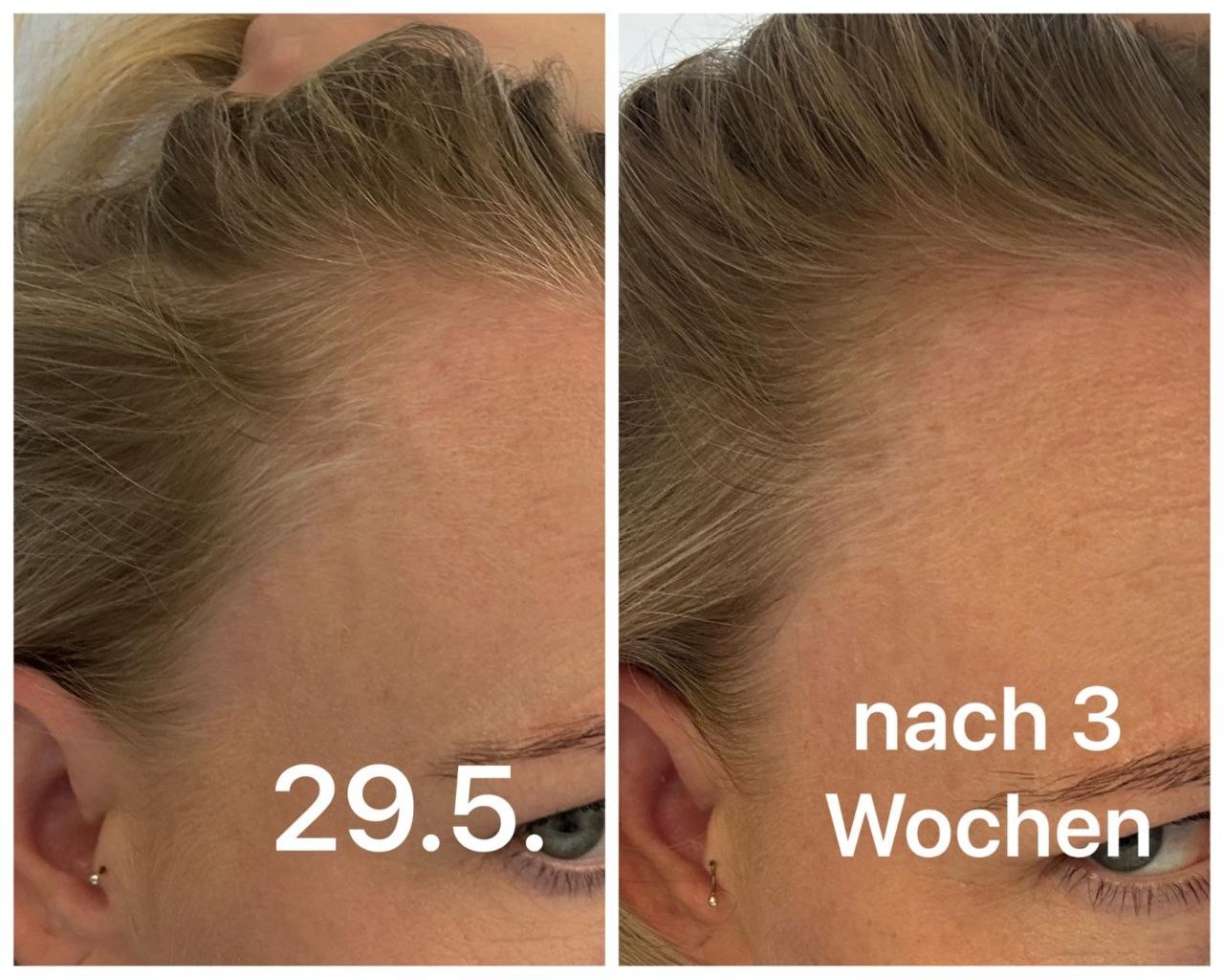 Ergebnis